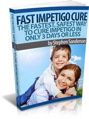Fast Impetigo Cure By Stephen Sanderson - eBook PDF Program